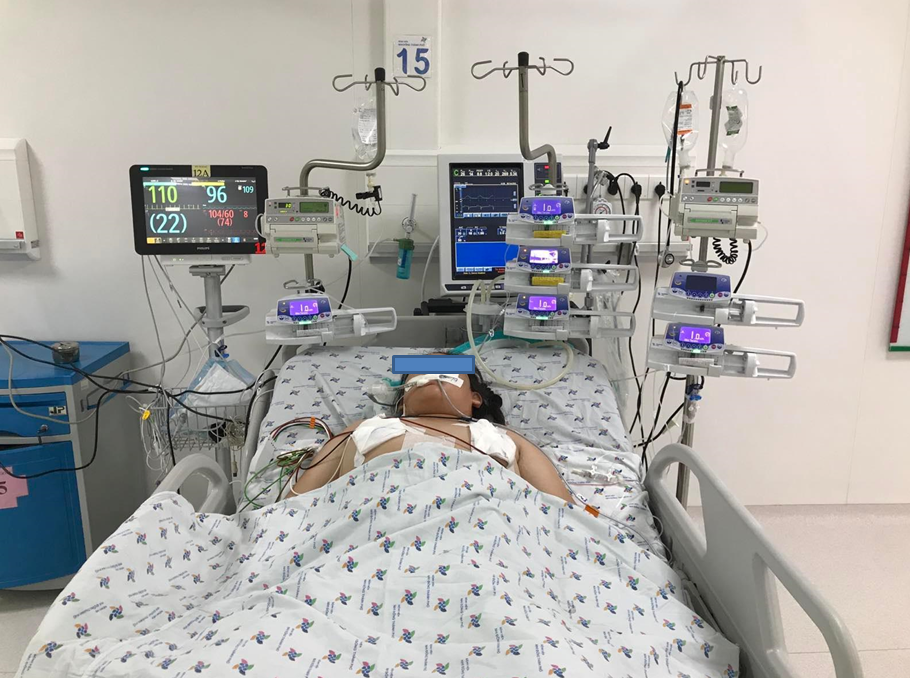 Trẻ P. T. T Tr. 13 tuổi, nữ, chấn thương nặng do tai nạn giao thông gây xuất huyết nội muộn, dễ bỏ sót, được hồi sức cấp cứu tích cực tại bệnh viện Nhi Đồng Thành Phố.