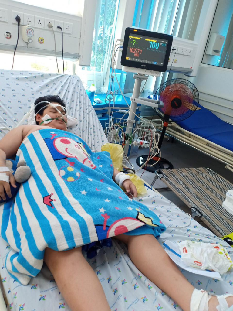 Trẻ Tr. M. Đ. 12 tuổi, nam, dư cân vừa mắc COVID-19 và sốc sốt xuất huyết suy hô hấp nặng