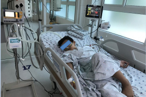 Chẩn đoán sốc sốt xuất huyết dengue nặng ngày 5, suy hô hấp tổn thương gan, rối loạn đông máu, được điều trị tích cực.