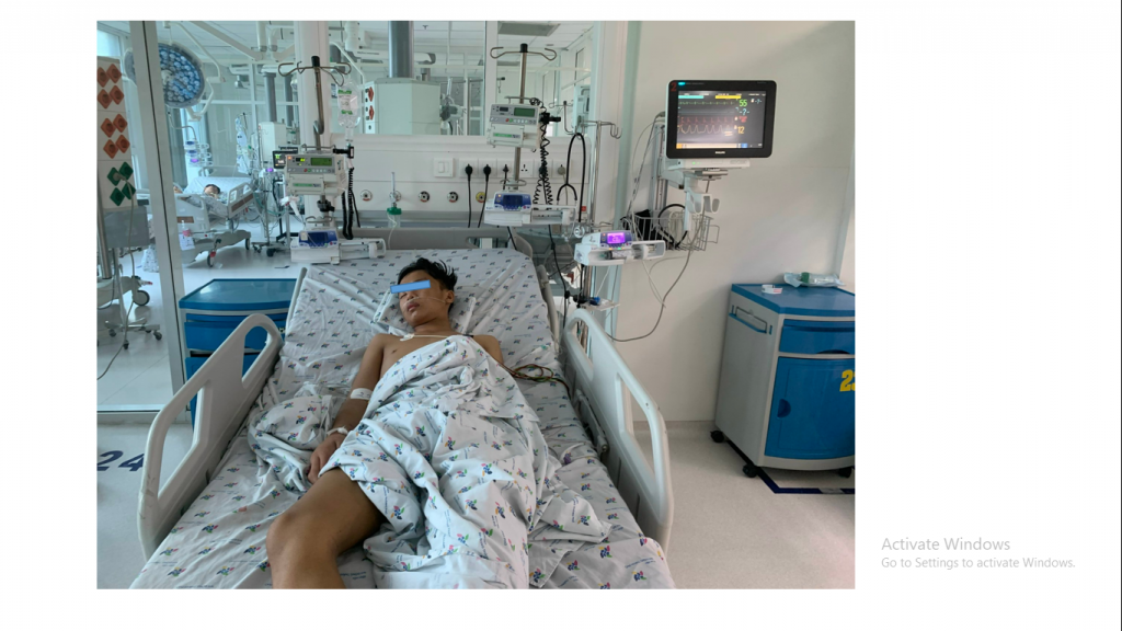 Young NG.  VV.  13 years old, male, diagnosed with severe Dengue hemorrhagic fever, N4 re-shock, prolonged shock, respiratory failure, severe gastrointestinal bleeding, receiving anti-shock therapy with active respiratory support, endoscopic hemostasis of gastric ulcers .