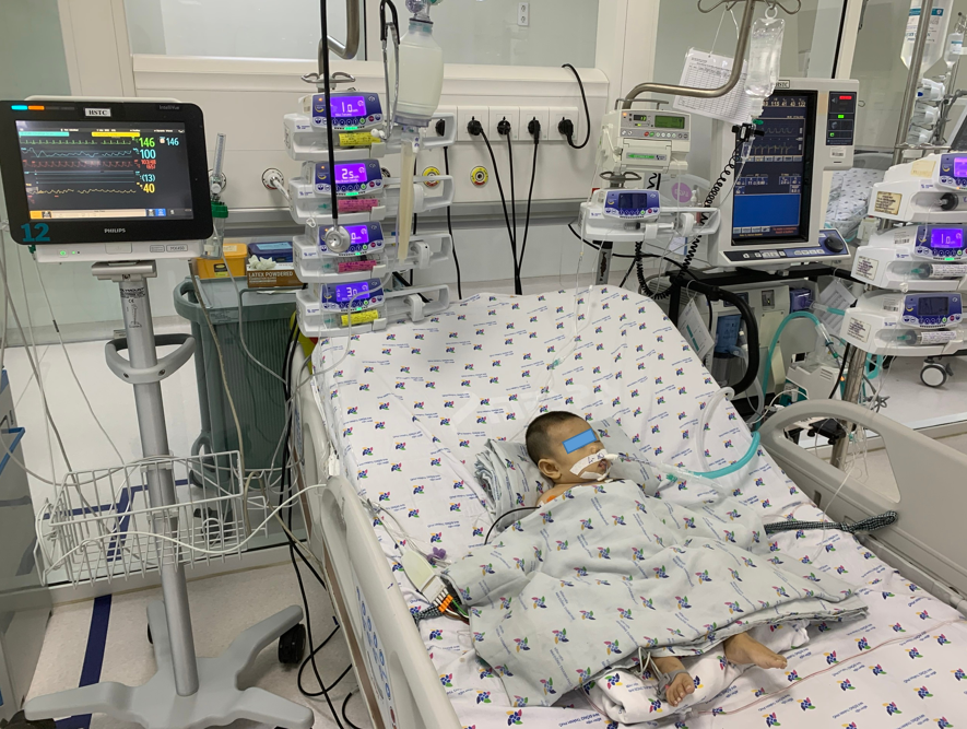 Children with fulminant myocarditis are actively treated with respiratory support, and infused with gammaglobuline antibodies