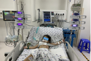 Trẻ P. N. P. TR, Nữ, 4 tuổi, đa chấn thương được điều trị tích cực tại khoa Hồi sức ngoại