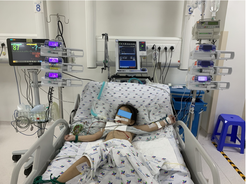 PNP TR, Female, 4-year-old, multi-trauma child is actively treated at the ICU