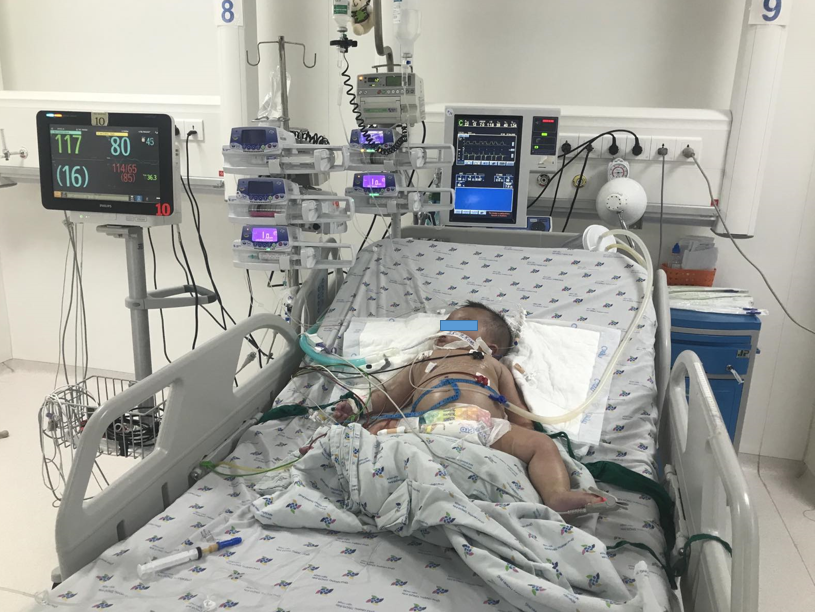 Infant QLN, 5 months, dengue hemorrhagic fever N5/traumatic brain injury/traffic accident, was actively treated at the ICU.