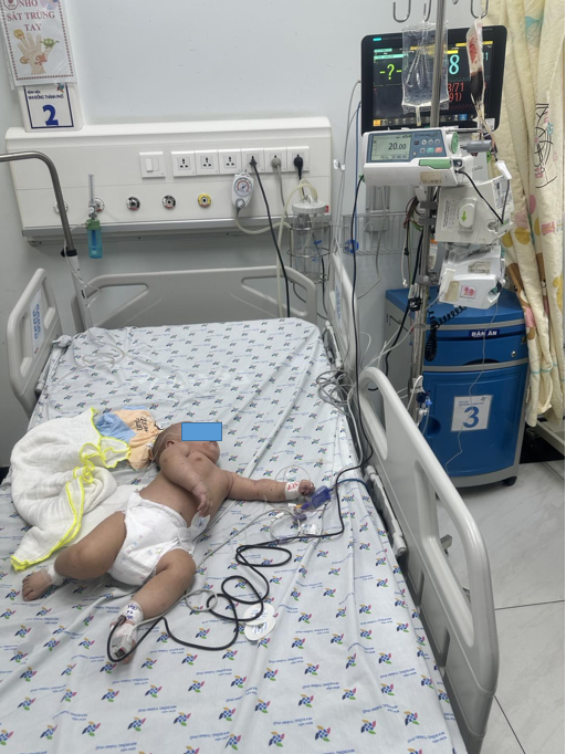 Trẻ H. T. K. 4 tháng tuổi, nam, ngụ ở Phú Yên, chẩn đoán sốc sốt xuất huyết, rối loạn đông máu, được chống sốc tích cực, truyền máu, huyết tương tươi động lạnh,  tiểu cầu.