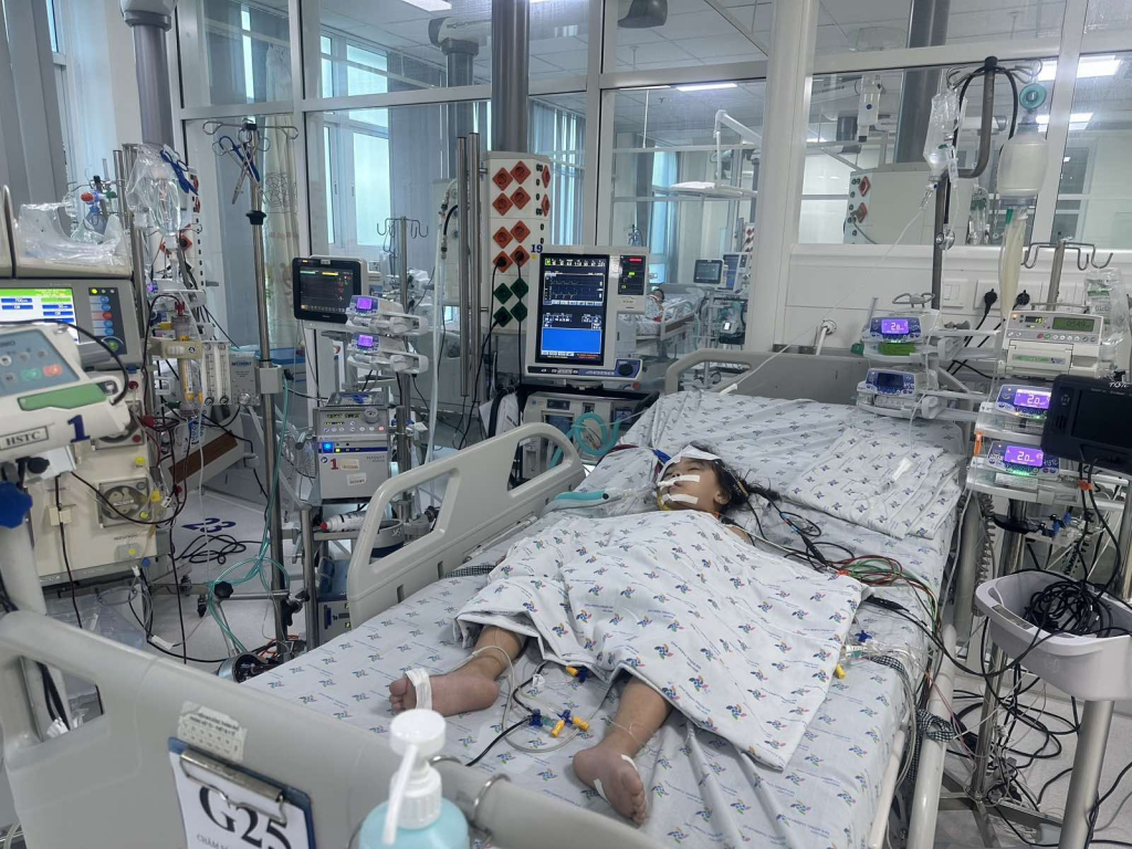Trẻ P. G. H. 3,5 tuổi, nữ, chẩn đoán bệnh tay chân miệng độ 4, được điều trị tích cực thở máy, lọc máu liên tục, truyền IVIG, ECMO