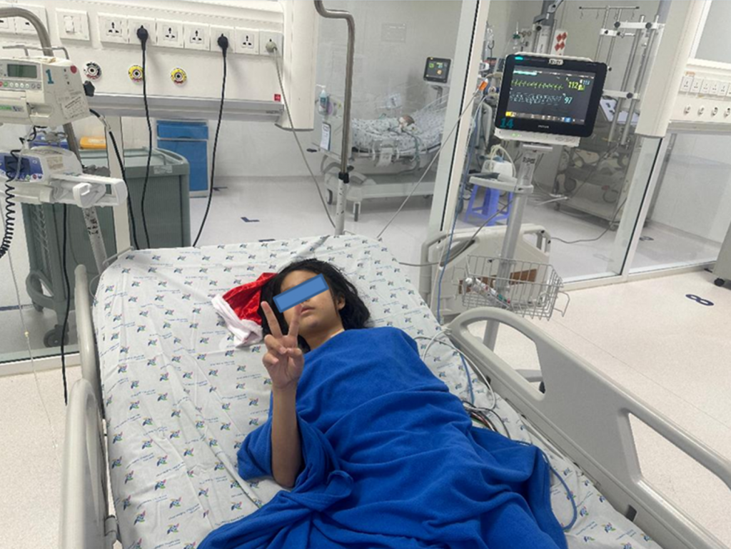 Sau gần 2 tuần điều trị trẻ phục hồi dần, cai được ECMO, máy thở, tỉnh táo