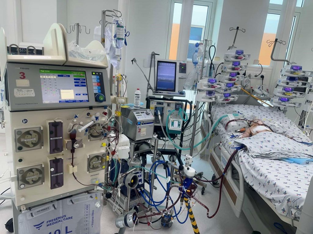 Trẻ C. N. M. P. Nữ, 7 tháng tuổi, tim bẩm sinh phức tạp được phẫu thuật triệt để, hỗ trợ ECMO và lọc máu liên tục.