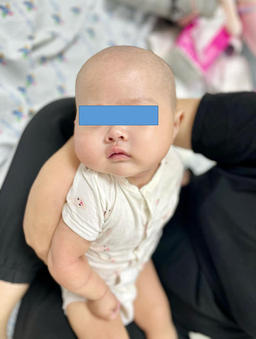 Kết quả sau gần 2 tuần chạy ECMO và lọc máu liên tục, trẻ đã bình phục sức khỏe hoàn toàn trong niềm vui khôn xiết của gia đình.