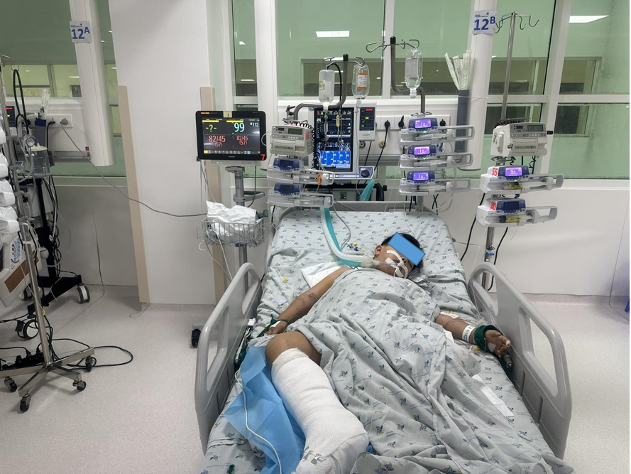 Trẻ P. M. T. nam, 9 tuổi, Chẩn đoán đa chấn thương sốc mất máu, gãy xương dập nát chân trái, vết thương cẳng bàn chân phải, vết thương tầng sinh môn, được các bác sĩ cấp cứu kịp thời và cố gắng bảo tồn phần chi có thể giữ được để tạo thuận lợi cho trẻ lắp chân giả sau này.