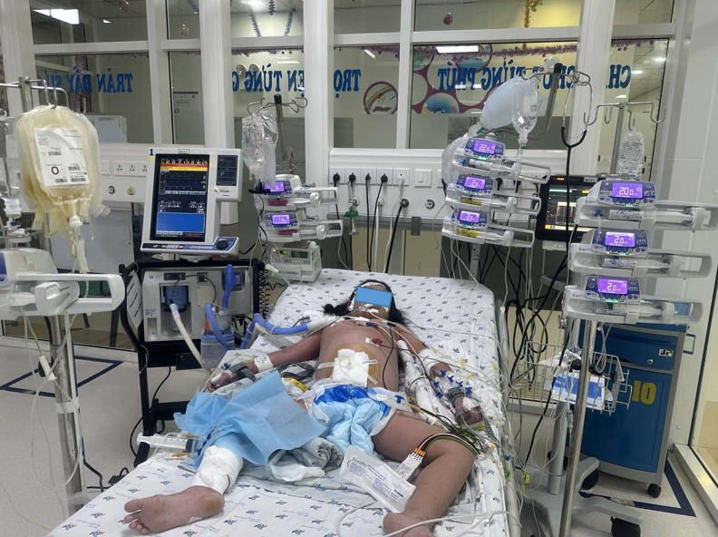 Trẻ V. Q. N. Y. 7 tuổi, nữ, chẩn đoán sốc sốt xuất huyết nặng N5, tổn thương gan, suy hô hấp nặng, được điều trị chống sốc, thở máy, điều chỉnh rối loạn đông máu, dẫn lưu dịch ổ bụng.