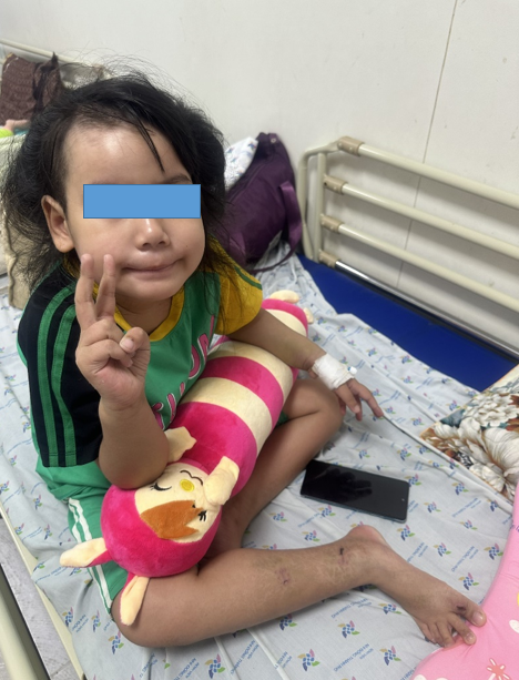 Sau gần 3 tuần điều trị, tình trạng trẻ cải thiện dần, cai được máy thở, tỉnh táo, chức năng gan thận trở về bình thường.