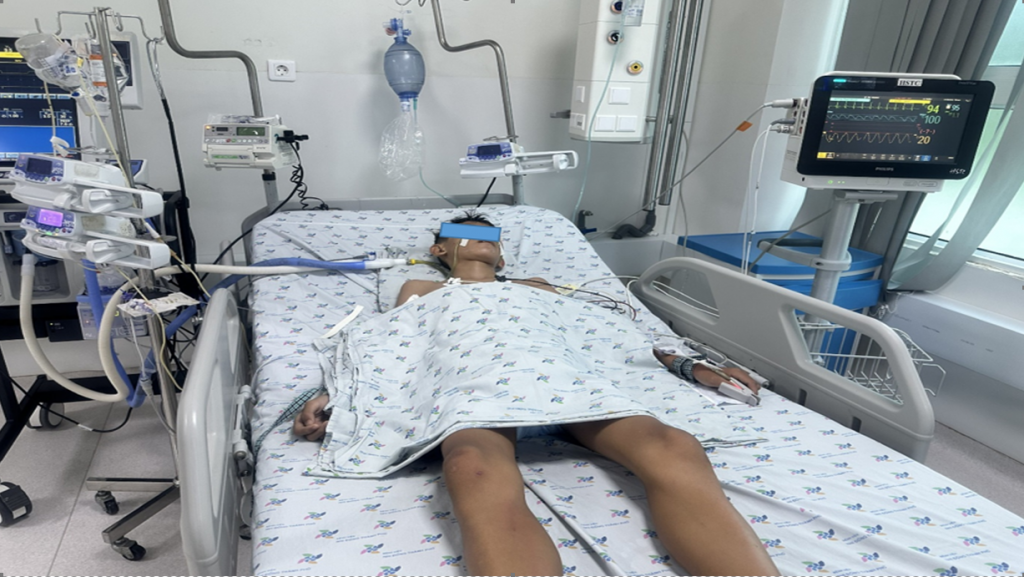 Trẻ Ng. N. Th. 15 tuổi, nam,.chẩn đoán ngạt nước, phù phổi cấp, thiếu oxy não, viêm phổi hít được điều trị tích cực thở máy, chống co giật, chống phù não, điều chỉnh nước điện giải, kháng sinh