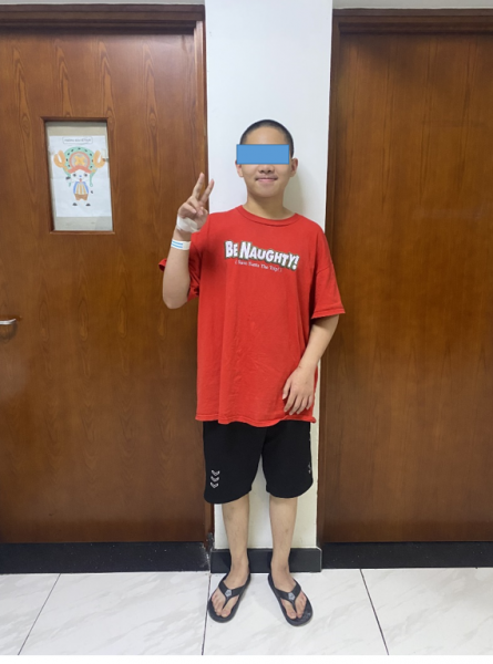 Cứu sống một trường hợp trẻ sốt xuất huyết nặng, xuất huyết phổi, suy hô hấp nặng