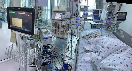 Áp dụng kỹ thuật oxy hóa máu qua màng ngoài cơ thể (ECMO) cứu sống trẻ bệnh tay chân miệng biến chứng suy hô hấp tuần hoàn tổn thương tim nặng